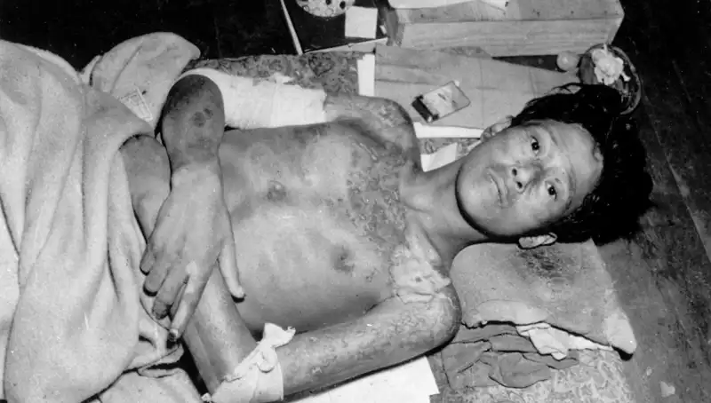80 Yıl Sonra Nagasaki: Nükleer Felaket Tehlikesi Yeniden Gündemde